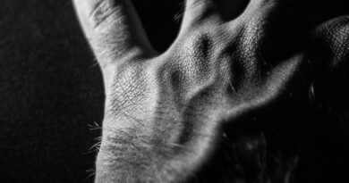 Vidljive vene: šta zaista znače i kada treba obratiti pažnju